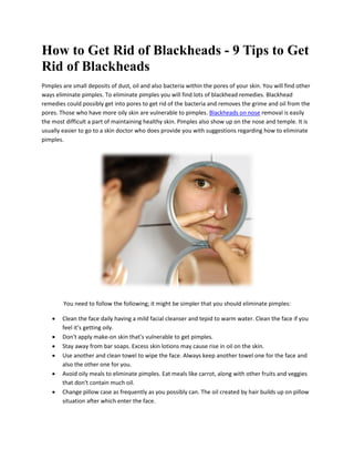 How to Get Rid of Blackheads - 9 Tips to Get
Rid of Blackheads
Pimples are small deposits of dust, oil and also bacteria within the pores of your skin. You will find other
ways eliminate pimples. To eliminate pimples you will find lots of blackhead remedies. Blackhead
remedies could possibly get into pores to get rid of the bacteria and removes the grime and oil from the
pores. Those who have more oily skin are vulnerable to pimples. Blackheads on nose removal is easily
the most difficult a part of maintaining healthy skin. Pimples also show up on the nose and temple. It is
usually easier to go to a skin doctor who does provide you with suggestions regarding how to eliminate
pimples.




        You need to follow the following; it might be simpler that you should eliminate pimples:

       Clean the face daily having a mild facial cleanser and tepid to warm water. Clean the face if you
        feel it’s getting oily.
       Don't apply make-on skin that's vulnerable to get pimples.
       Stay away from bar soaps. Excess skin lotions may cause rise in oil on the skin.
       Use another and clean towel to wipe the face. Always keep another towel one for the face and
        also the other one for you.
       Avoid oily meals to eliminate pimples. Eat meals like carrot, along with other fruits and veggies
        that don't contain much oil.
       Change pillow case as frequently as you possibly can. The oil created by hair builds up on pillow
        situation after which enter the face.
 