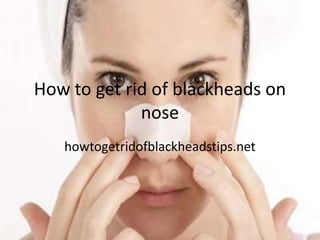How to get rid of blackheads on
             nose
   howtogetridofblackheadstips.net
 
