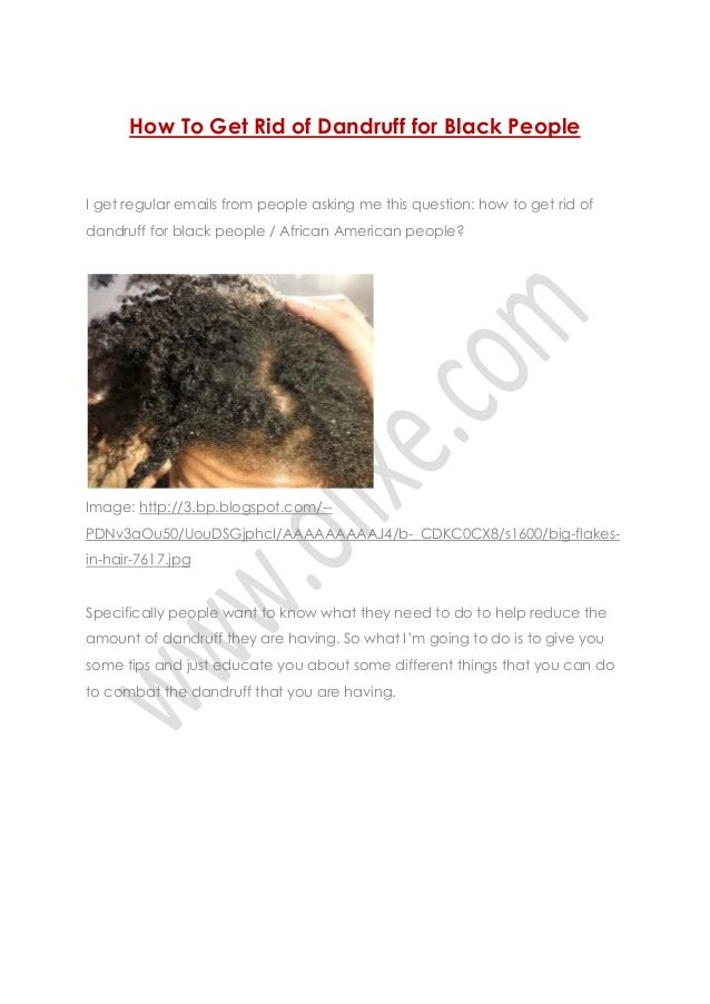 How To Get Rid of Dandruff for Black People - Hair Care - www.olixe.com