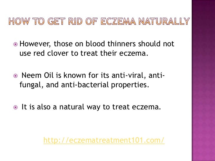 Natural Ways To Get Rid Of Psoriasis Natural Ways To Get Rid Of Psoriasis