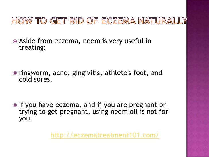 Natural Ways To Get Rid Of Psoriasis Natural Ways To Get Rid Of Psoriasis