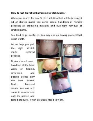 How To Get Rid Of Embarrassing Stretch Marks?
When you search for an effective solution that will help you get
rid of stretch marks you come across hundreds of miracle
products all promising miracles and overnight removal of
stretch marks.
You tend to get confused. You may end up buying product that
is not worth.
Let us help you pick
the right stretch
mark        removal
product.
Nostretchmarks.net
has done all the hard
work of finding,
reviewing         and
putting across only
the best Stretch
Mark         Removal
cream. You can rely
on us to recommend
only the proven and
tested products, which are guaranteed to work.
 