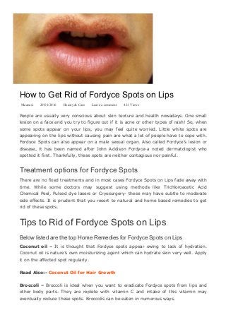 How to Get Rid of Fordyce Spots on Lips
Maanasi   20/01/2016   Beauty & Care   Leave a comment   421 Views
People are usually very conscious about skin texture and health nowadays. One small
lesion on a face and you try to figure out if it is acne or other types of rash! So, when
some  spots  appear  on  your  lips,  you  may  feel  quite  worried.  Little  white  spots  are
appearing on the lips without causing pain are what a lot of people have to cope with.
Fordyce Spots can also appear on a male sexual organ. Also called Fordyce’s lesion or
disease,  it  has  been  named  after  John  Addison  Fordyce­a  noted  dermatologist  who
spotted it first. Thankfully, these spots are neither contagious nor painful.
Treatment options for Fordyce Spots
There are no fixed treatments and in most cases Fordyce Spots on Lips fade away with
time.  While  some  doctors  may  suggest  using  methods  like  Trichloroacetic  Acid
Chemical Peel, Pulsed dye lasers or Cryosurgery­ these may have subtle to moderate
side effects. It is prudent that you resort to natural and home based remedies to get
rid of these spots.
Tips to Rid of Fordyce Spots on Lips
Below listed are the top Home Remedies for Fordyce Spots on Lips
Coconut  oil  – It  is  thought  that  Fordyce  spots  appear  owing  to  lack  of  hydration.
Coconut oil is nature’s own moisturizing agent which can hydrate skin very well. Apply
it on the affected spot regularly.
Read Also:­ Coconut Oil for Hair Growth
Broccoli – Broccoli is ideal when you want to eradicate Fordyce spots from lips and
other  body  parts.  They  are  replete  with  vitamin  C  and  intake  of  this  vitamin  may
eventually reduce these spots. Broccolis can be eaten in numerous ways.
 