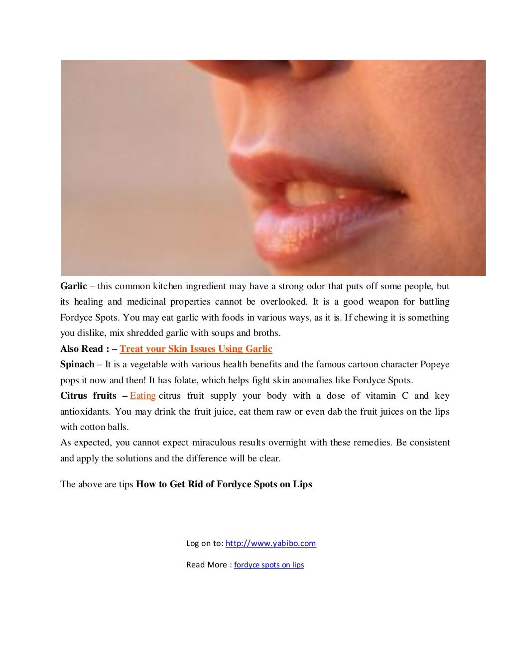 How to get rid of fordyce spots on lips