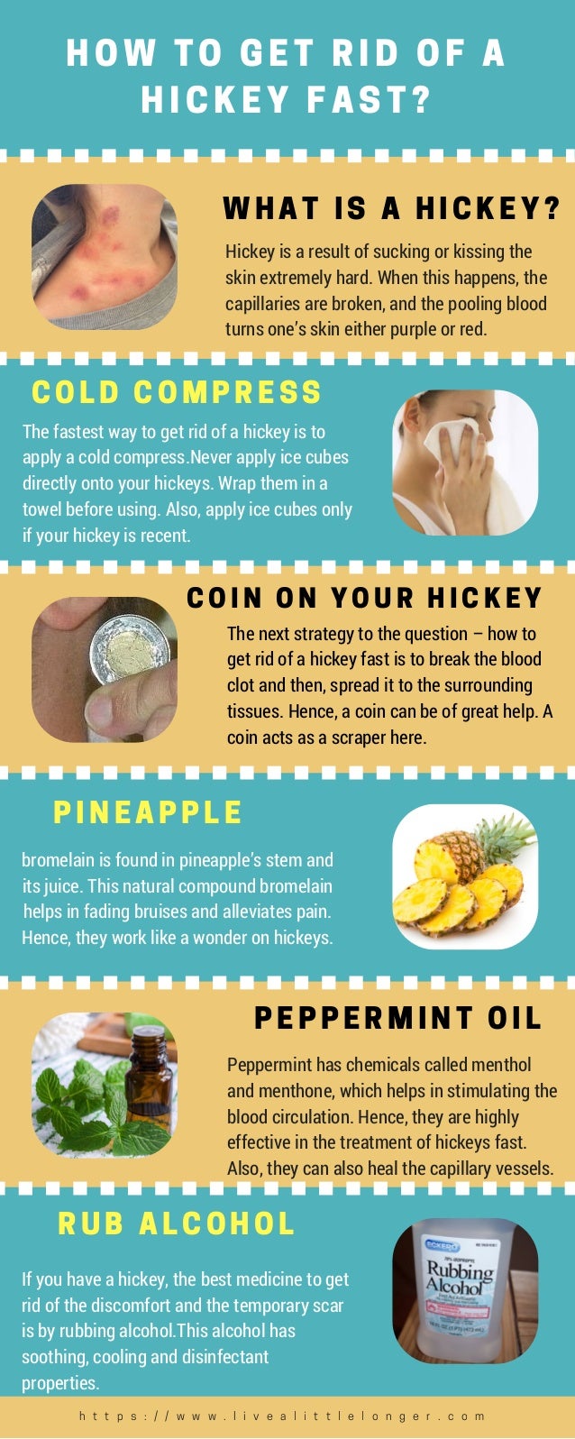 ways to get rid of a hickey within 24 hrs 