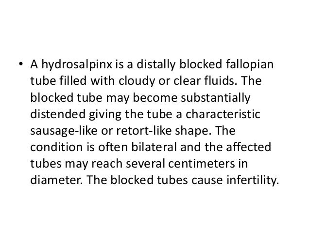 Natural Ways To Get Rid Of Blocked Fallopian Natural Ways To Get Rid Of Blocked Fallopian