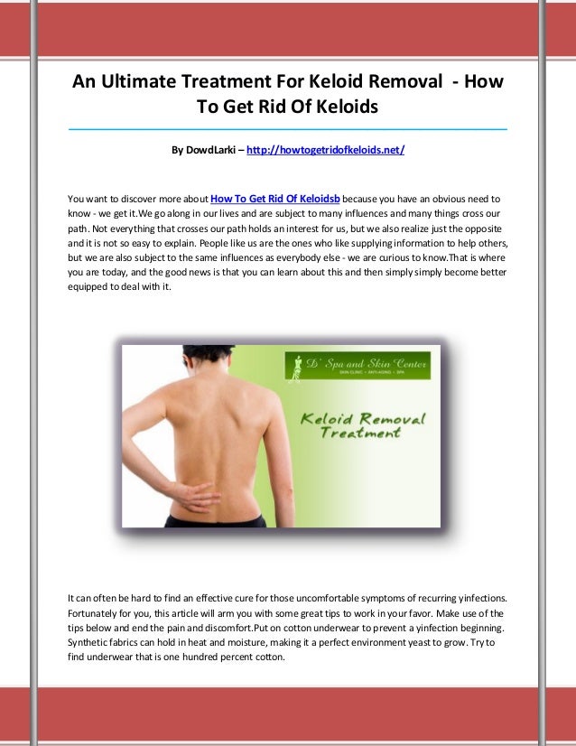 How to get rid of keloids