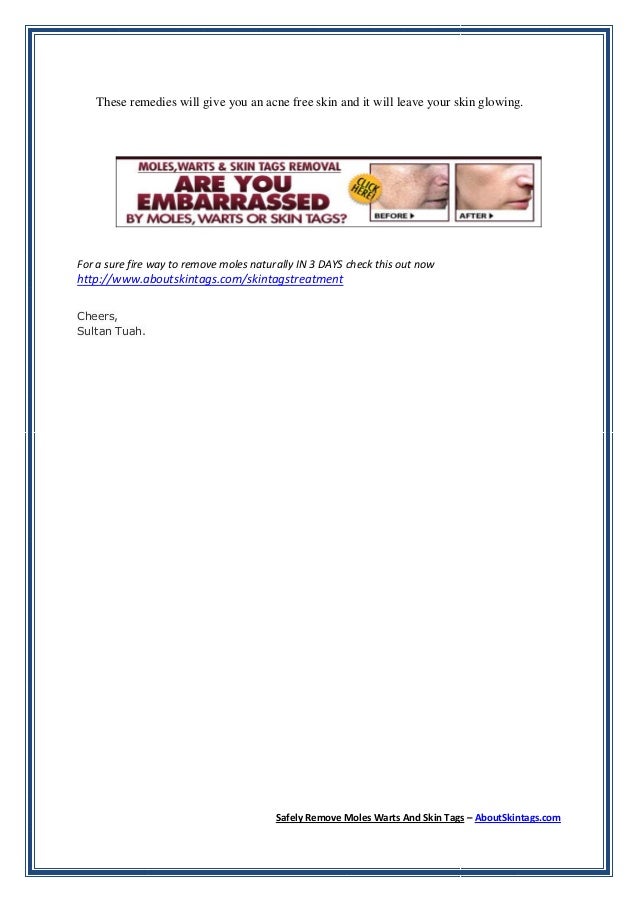 Best Way To Remove Moles On Face Naturally Best Way To Remove Moles On Face Naturally