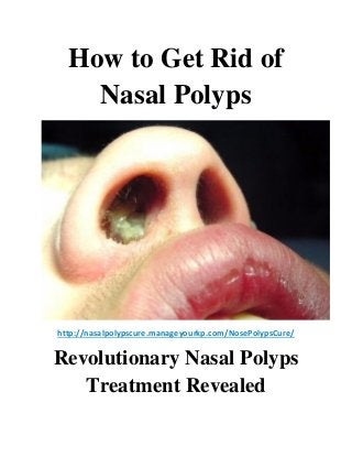 How to Get Rid of
Nasal Polyps
http://nasalpolypscure.manageyourkp.com/NosePolypsCure/
Revolutionary Nasal Polyps
Treatment Revealed
 