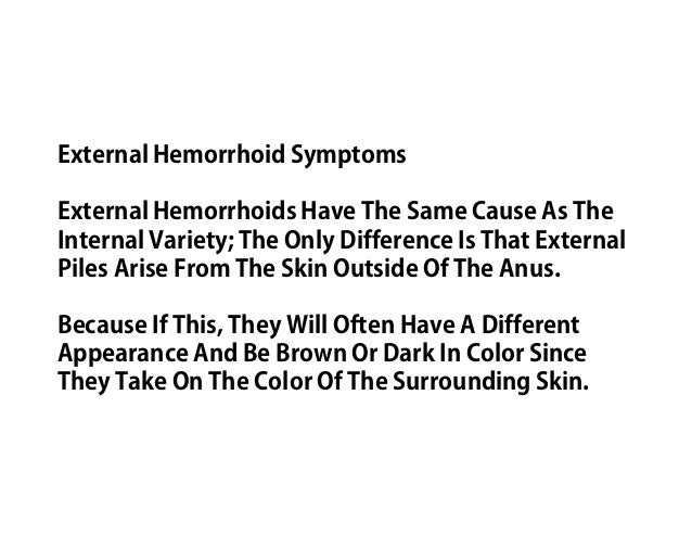 How To Get Rid Of An External Hemorrhoid Naturally How To Get Rid Of An External Hemorrhoid Naturally