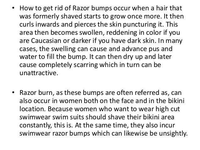 How To Get Rid Of Razor Bumps After Haircut