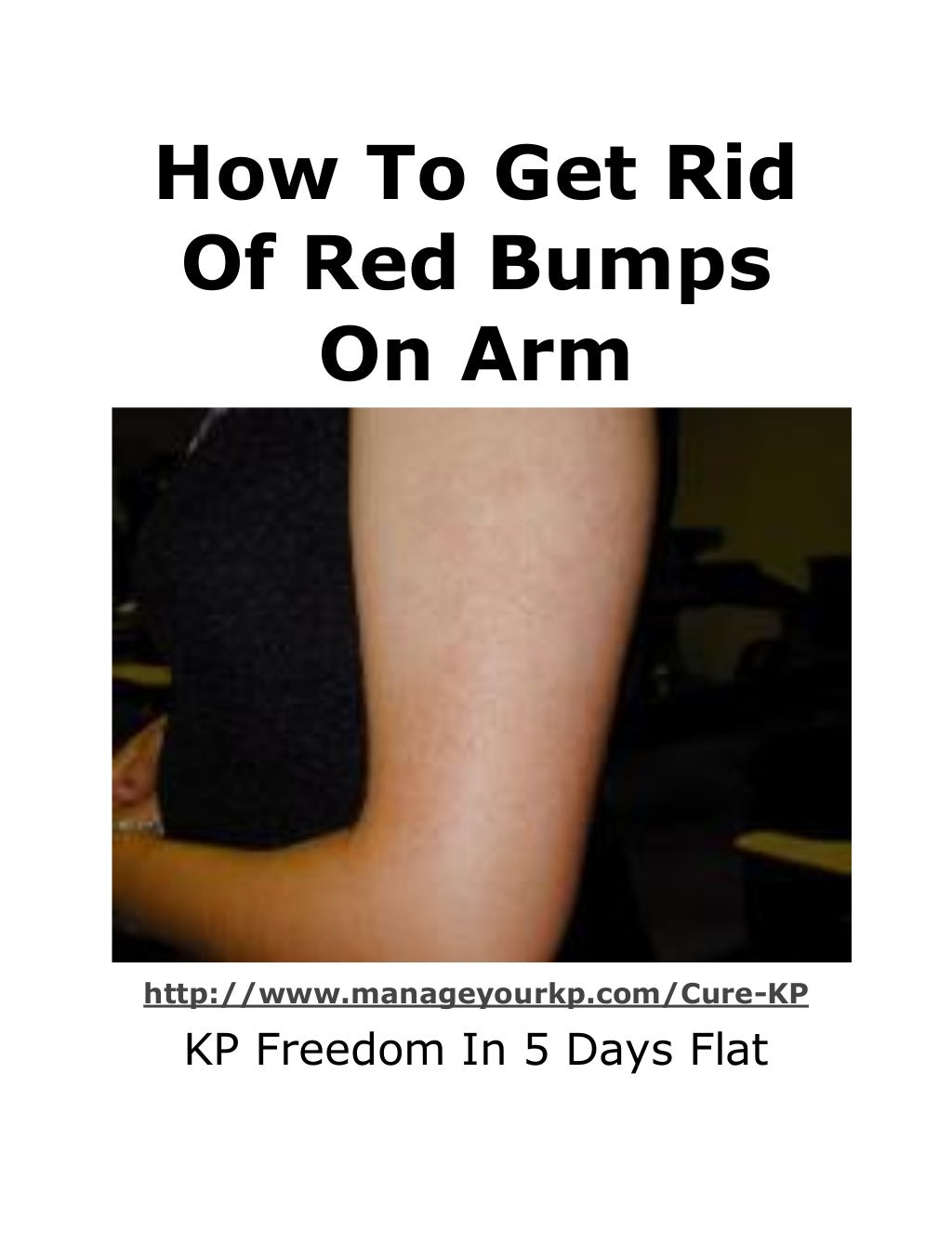 How to get rid of red bumps on arm