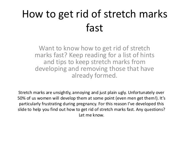 How To Get Rid Of Stretch Marks Naturally Wikihow How To Get Rid Of Stretch Marks Naturally Wikihow