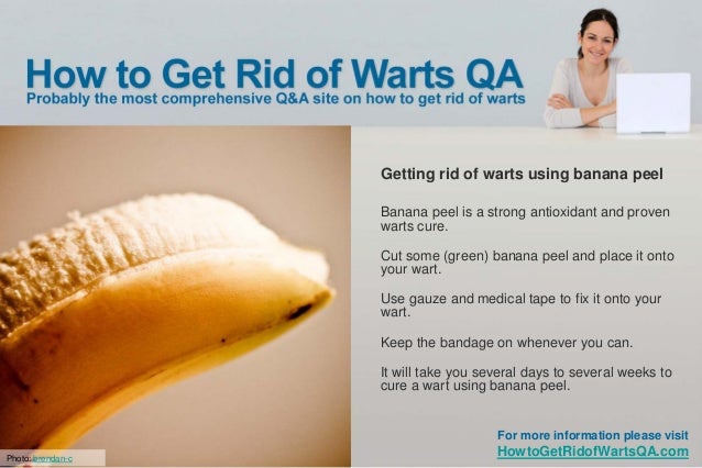 How To Remove Plantar Warts Naturally How To Remove Plantar Warts Naturally