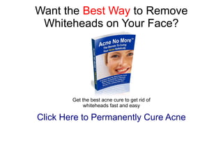 Want the Best Way to Remove
 Whiteheads on Your Face?




        Get the best acne cure to get rid of
             whiteheads fast and easy

Click Here to Permanently Cure Acne
 