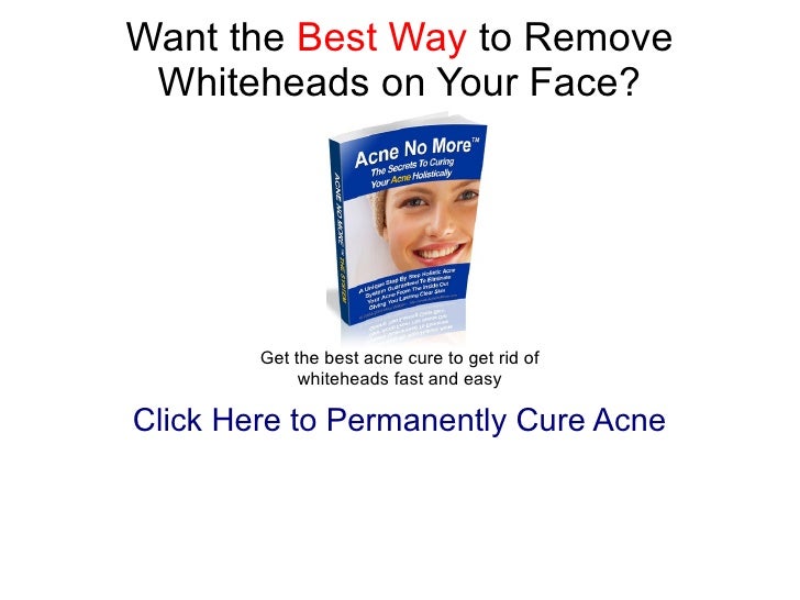 How to get rid of whiteheads on eyelids
