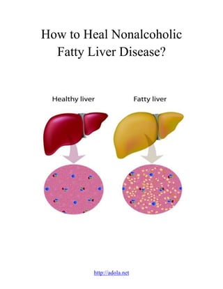 http://adola.net
How to Heal Nonalcoholic
Fatty Liver Disease?
 