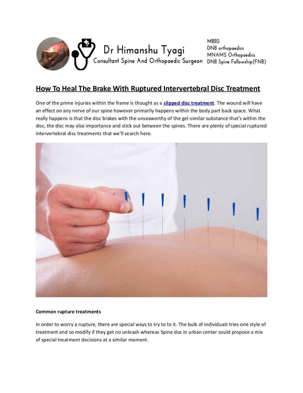 How To Heal The Brake With Ruptured Intervertebral Disc Treatment