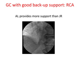 GC with good back-up support: RCA
AL provides more support than JR