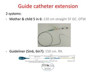 Guide catheter extension
2 systems:
- Mother & child 5 in 6: 120 cm straight 5F GC. OTW
- Guideliner (5in6, 6in7): 150 cm. RX.