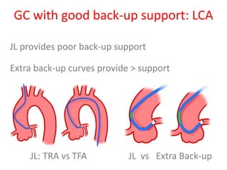 GC with good back-up support: LCA
JL provides poor back-up support
Extra back-up curves provide > support
JL: TRA vs TFA JL vs Extra Back-up