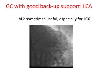 GC with good back-up support: LCA
AL2 sometimes useful, especially for LCX