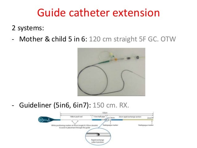 guideliner catheter ppt guideliner catheter ppt