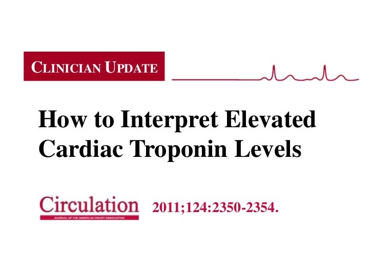 heart i trop test Cardiac Levels Elevated to Interpret How Troponin heart i trop test Cardiac Levels Elevated to Interpret How Troponin