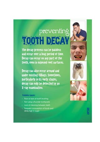 decay
preventing
Tooth Decay
The decay process can be painless
and occur over a long period of time.
Decay can occur on any part of the
tooth, even in exposed root surfaces.
Decay can also occur around and
under existing fillings. Sometimes,
particularly in its early stages,
decay can only be detected by an
X-ray examination.
Common causes:
–	 Poor or lack of tooth brushing
–	 Not using a fluoride toothpaste
–	 Lack of cleaning between teeth
–	 Frequent consumption of foods and
drinks high in sugar
 