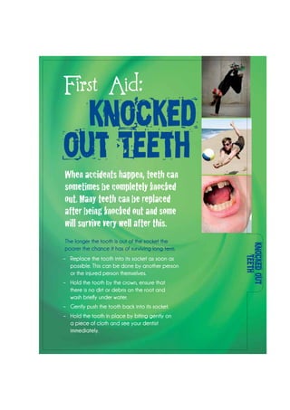 Knocked-out
Teeth
First Aid:
knocked-
out Teeth
When accidents happen, teeth can
sometimes be completely knocked
out. Many teeth can be replaced
after being knocked out and some
will survive very well after this.
The longer the tooth is out of the socket the
poorer the chance it has of surviving long term.
–	 Replace the tooth into its socket as soon as
possible. This can be done by another person
or the injured person themselves.
–	 Hold the tooth by the crown, ensure that
there is no dirt or debris on the root and
wash briefly under water.
–	 Gently push the tooth back into its socket.
–	 Hold the tooth in place by biting gently on
a piece of cloth and see your dentist
immediately.
 