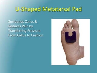 U-Shaped Metatarsal Pad
Surrounds Callus &
Reduces Pain by
Transferring Pressure
From Callus to Cushion
 
