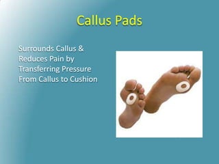 Callus Pads
Surrounds Callus &
Reduces Pain by
Transferring Pressure
From Callus to Cushion
 