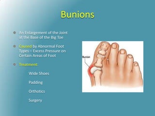 Bunions
An Enlargement of the Joint
at the Base of the Big Toe
Caused by Abnormal Foot
Types – Excess Pressure on
Certain Areas of Foot
Treatment:
Wide Shoes
Padding
Orthotics
Surgery
 