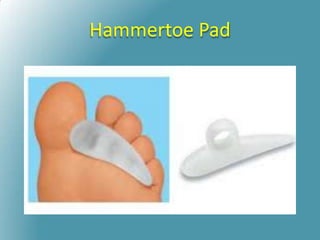 Hammertoe Pad
 