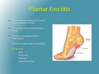 Plantar Fasciitis
Inflammation of Band of Tissue
Along Bottom of Foot
Tissue Becomes Strained Over
Time
Common Amongst Active
Individuals
Results in Heel Pain & Swelling
Treatment:
Icing
Stretching
Orthotics
Supportive Shoes
 