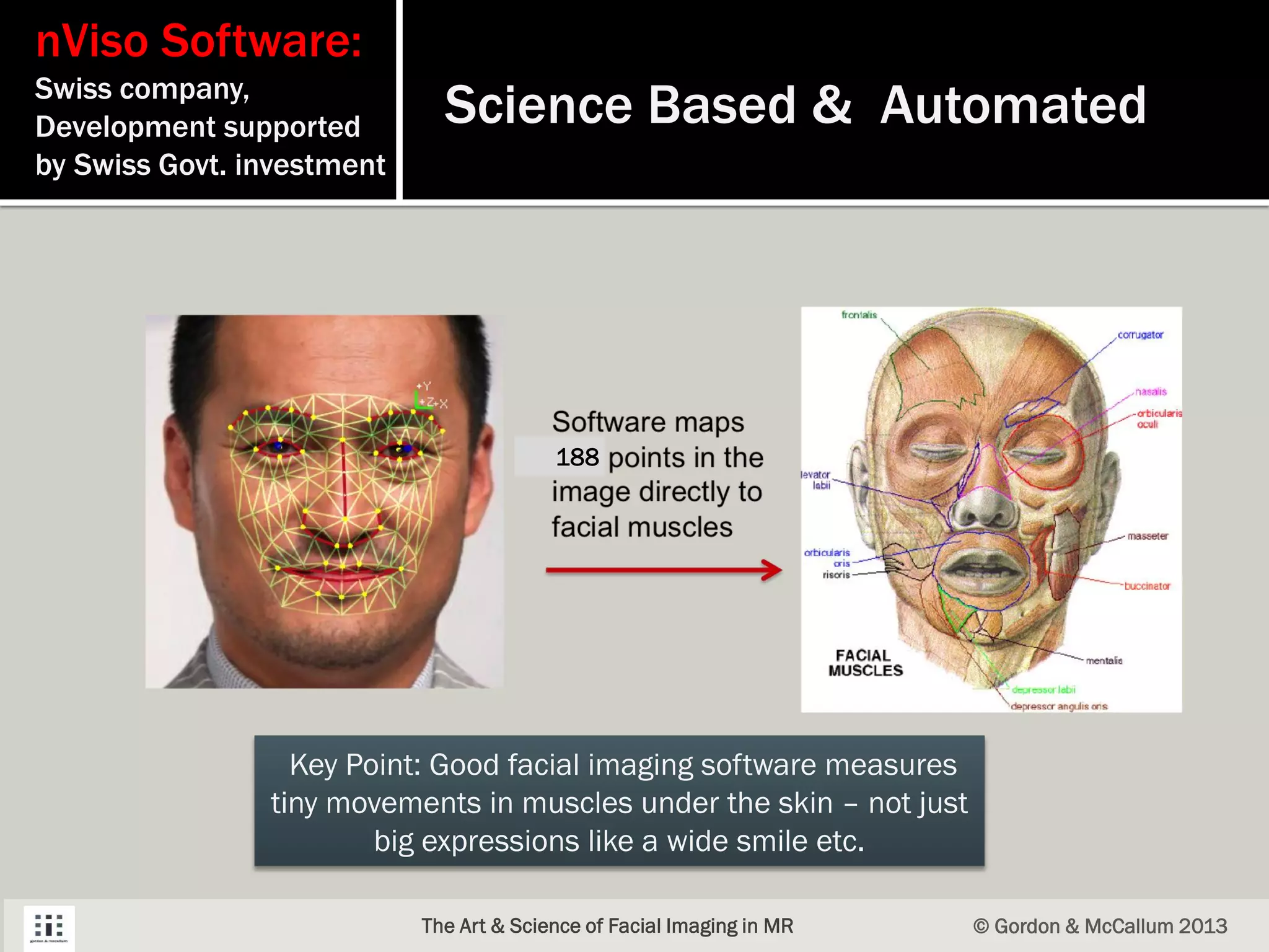 nViso Software:
Swiss company,
Development supported
by Swiss Govt. investment
© Gordon & McCallum 2013The Art & Science of Facial Imaging in MR
Science Based & Automated
Key Point: Good facial imaging software measures
tiny movements in muscles under the skin – not just
big expressions like a wide smile etc.
188
 
