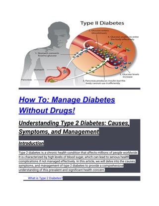 How To: Manage Diabetes
Without Drugs!
Understanding Type 2 Diabetes: Causes,
Symptoms, and Management
Introduction
Type 2 diabetes is a chronic health condition that affects millions of people worldwide.
It is characterized by high levels of blood sugar, which can lead to serious health
complications if not managed effectively. In this article, we will delve into the causes,
symptoms, and management of type 2 diabetes to provide a comprehensive
understanding of this prevalent and significant health concern.
​ What is Type 2 Diabetes?
 
