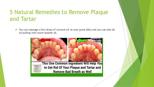 How To Remove Tartar Naturally How To Remove Tartar Naturally