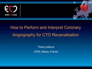 How to Perform and Interpret Coronary
Angiography for CTO Recanalisation
Thierry lefèvre
ICPS, Massy, France
 