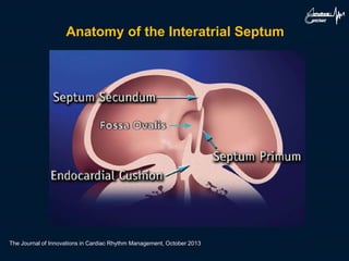 The Journal of Innovations in Cardiac Rhythm Management, October 2013
Anatomy of the Interatrial Septum
 