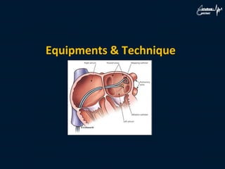 Equipments & Technique
 
