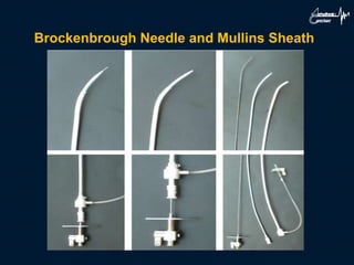 Brockenbrough Needle and Mullins Sheath
 