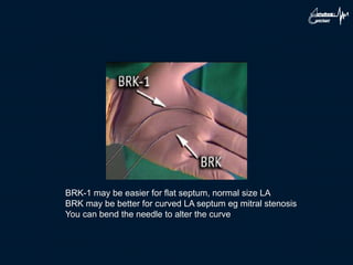 BRK-1 may be easier for flat septum, normal size LA
BRK may be better for curved LA septum eg mitral stenosis
You can bend the needle to alter the curve
 