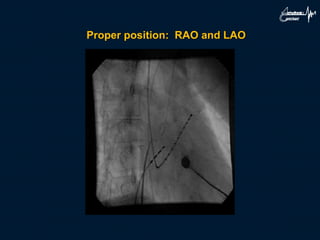 Proper position: RAO and LAO
 
