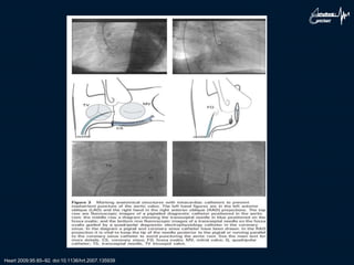 Heart 2009;95:85–92. doi:10.1136/hrt.2007.135939
 