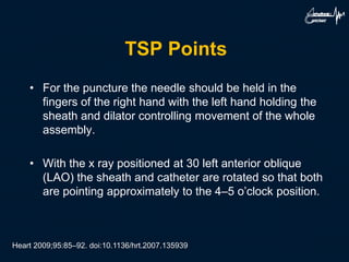 TSP Points
• For the puncture the needle should be held in the
fingers of the right hand with the left hand holding the
sheath and dilator controlling movement of the whole
assembly.
• With the x ray positioned at 30 left anterior oblique
(LAO) the sheath and catheter are rotated so that both
are pointing approximately to the 4–5 o’clock position.
Heart 2009;95:85–92. doi:10.1136/hrt.2007.135939
 
