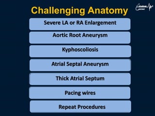 Challenging Anatomy
Severe LA or RA Enlargement
Aortic Root Aneurysm
Kyphoscoliosis
Atrial Septal Aneurysm
Thick Atrial Septum
Pacing wires
Repeat Procedures
 