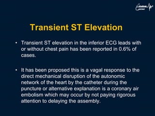 Transient ST Elevation
• Transient ST elevation in the inferior ECG leads with
or without chest pain has been reported in 0.6% of
cases.
• It has been proposed this is a vagal response to the
direct mechanical disruption of the autonomic
network of the heart by the catheter during the
puncture or alternative explanation is a coronary air
embolism which may occur by not paying rigorous
attention to delaying the assembly.
 
