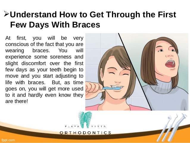 how to prepare for getting braces 17