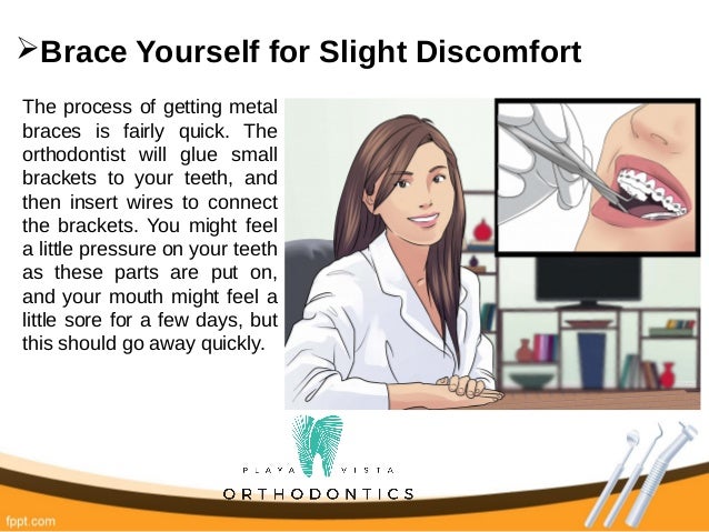 How to Prepare for Getting Braces